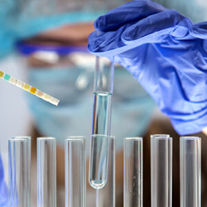 Lead Test